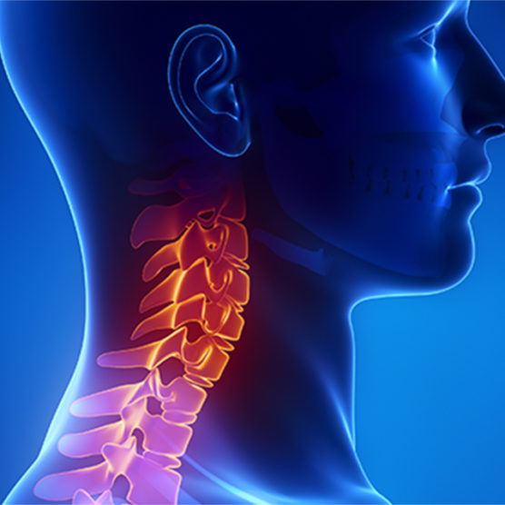 Médico indica os principais sinais do câncer de cabeça e pescoço